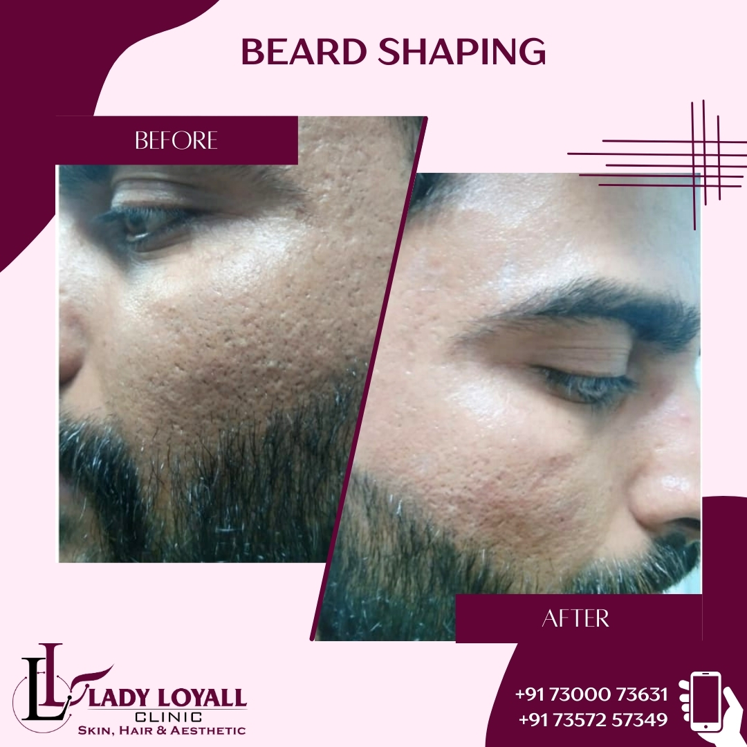 Beard Shaping