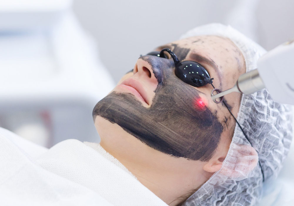 Carbon Laser Facial in Jaipur